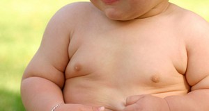 Medication Use Higher Among Obese Kids